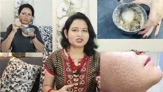 चेहरे के बड़े बड़े गड्डे क्लीअर करने के लिए होममेड नैचरल मास्क | 40plusmom