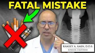 Smoking, Vaping, Marijuana and Dental Implants