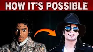 Michael Jackson Success Story | Black To White Skin | Controversies