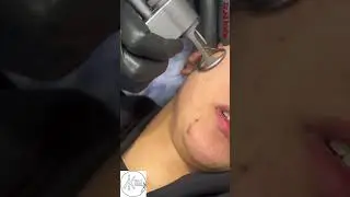 @Dr.alikusha Dr.Ali Kusha #beautyclinic #beautycenter #asmr #doctorlife #shorts #viral 