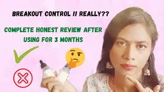DECONSTRUCT SKINCARE | BREAKOUT control serum | Does it work on ACNE, REDNESS, HYPERPIGMENTATION??