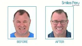 James Lowdell Testimonial | Smiles Peru