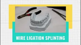 Splinting Gigi (Wire Ligation Splint)