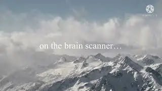 zombie scan crazy brain