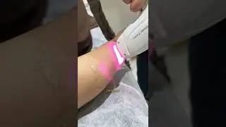 Clinic Dermatech || Laser Hair Reduction. #skincare