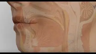 Submucosal Base of Tongue Reduction for Sleep Apnea