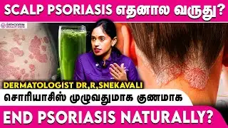Scalp Psoriasis எதனால வருது? | சொரியாசிஸ் முழுவதுமாக குணமாக | Dermatologist Tips | Orthoderm Centre