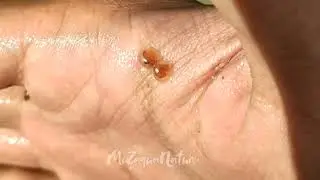 Clam Shrimp (Diplostraca)