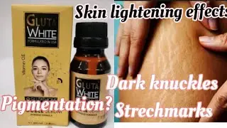 How Glutha White Skin Lightening Serum changed my Skin; whitening Serum, Side Effects,