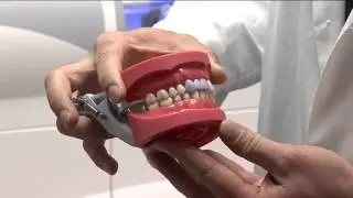 Wilkinson Dental - Same-Day Crowns and Veneers