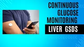 Continuous Glucose Monitoring in Liver GSDs: Towards Recommendations for Clinical Targets