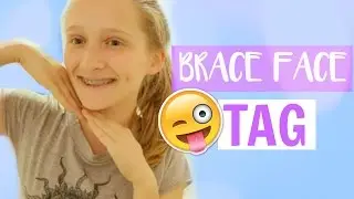 BRACE FACE TAG (braces experience!)