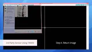 Dexis software - Clio Digital Xray sensor demo