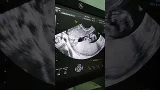بنت ولا ولد