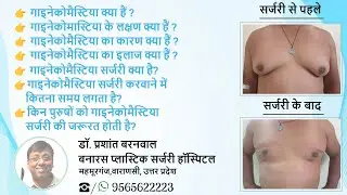 Gynecomastia Surgery in Varanasi | गाइनेकोमैस्टिया क्या हैं |  कारण , लक्षण और इसका इलाज क्या हैं