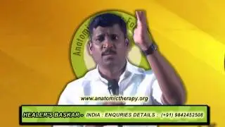 Solution for Varicose Veins?    Healer Baskar (Peace O Master)