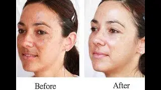 100% effective |  homemade Egyptian skin whitening scrub | Cleopatra's way !