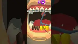 #asmr #kids #trending #boys #game #tooth extraction #tooth straighting #kids shorts