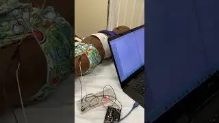 Capstone Design Project Biomedical Engineering | Testing Using Our Beloved SimBaby | #BME490