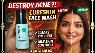 Best Face Wash for Daily Use? | CureSkin Gentle Cleanse Honest Review