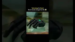 This Girl&rsquo;s Arm Moves Even When It&rsquo;s Not Attached! 🤯 | Real-Life Bionic Tech #shorts