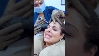 Hair PRP Treatment that Gave Tanaaz Irani Gorgeous, Voluminous Hair! #beauty #hairlosssolution