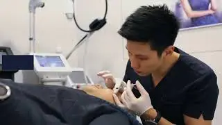 Acne Scar Removal Treatment in Singapore (Dr Justin Boey)