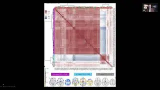 Trends in Neuroimaging Analysis: Virtual Talk at the University of Connecticut