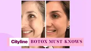 4 fast facts you'll want to know about Botox