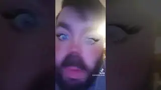 Blue removal .... blue removal