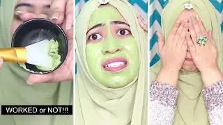LAIKOU Matcha Mud Mask Review-How to use? আসলেই কি কাজ করে ফাংগাল একনে, পিম্পল এর বিরুদ্ধে?🤔