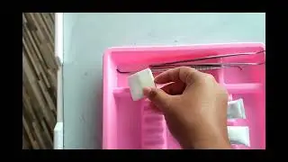 Calcium Hydroxide Liner use and application / Dycal Liner