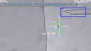 The BAIBYS&trade; system autonomous sperm sample scan and robotic pickup of an ideal sperm cell