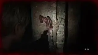 Silent Hill 2 Remake Pt. 5- Series X