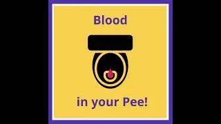 Common Symptoms of Bladder Cancer