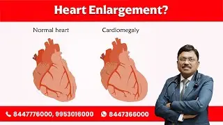 Heart Enlargement? by Dr. Bimal Chhajer