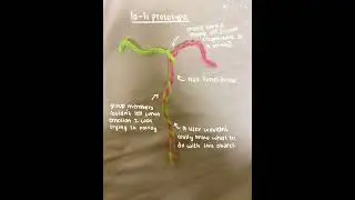 presentation