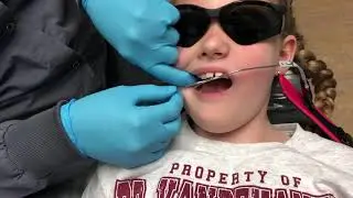 Getting braces part 3 (headgear)