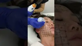 Did you know Thermage can help reduce the appearance of Cellulite? | Rejuuv Medi Spa