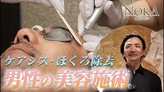 【美容施術】ケアシス・ほくろ除去・医療脱毛 男性の美容施術に密着