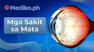 Mga Sakit Sa Mata