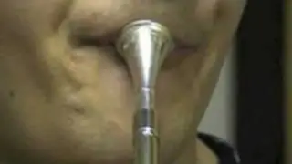 2 th French horn player and Embouchure Dystonic Syndrome (embouchure dystonia)