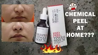 So Natural Red Peel Tingle Serum 리뷰 | K-BEAUTY