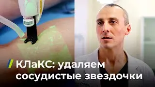 КЛаКС: удаляем сосудистые звездочки