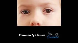 Episode 365: #85-1 Common Eye Issues: Viral Conjunctivitis