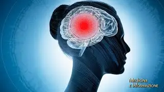ICTUS ISCHEMICO: CON LA TROMBECTOMIA MECCANICA E' POSSIBILE 
