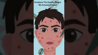 Smallpox The Deadly Plague We Actually Erased