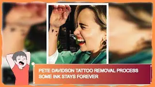 Pete Davidson Tattoo Removal Process Some Ink Stays Forever