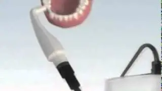Assessing Implant Stability