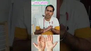Hand, foot and mouth disease.......Common in rainy days Spread in children....Itchy lesions